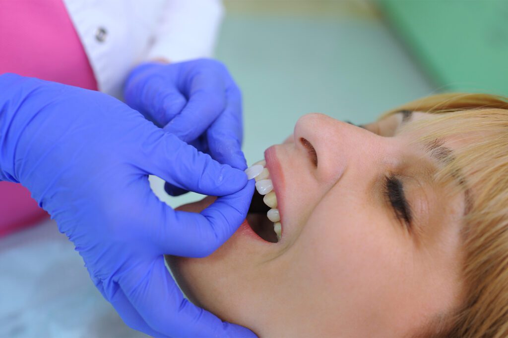 Woman receiving denture implants
