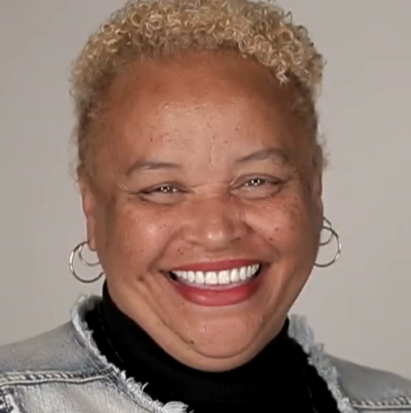 the after photo of a woman smiling ear to ear with a perfect new smile